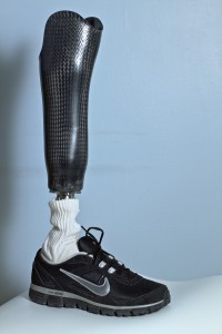 Midlands Prosthetic Leg